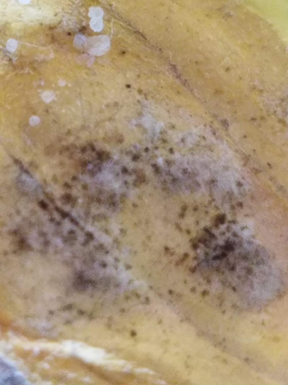 Magnified Early Blight spores | The Coeur d Alene Coop